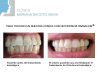 guia33-cornella-clinica-dental-clinica-dental-dra-mariana-sacoto-cornella-15933.jpg