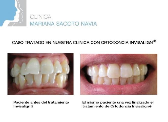 guia33-cornella-clinica-dental-clinica-dental-dra-mariana-sacoto-cornella-15933.jpg