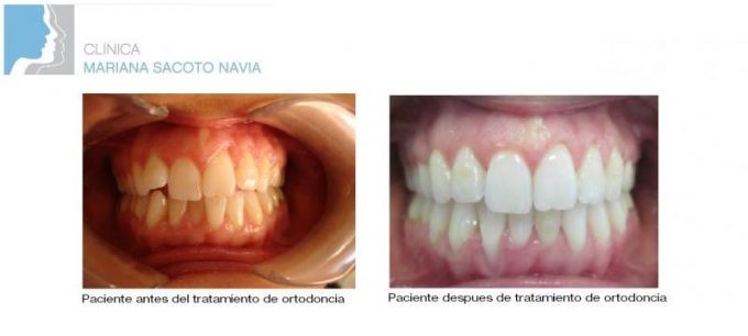 guia33-cornella-clinica-dental-clinica-dental-dra-mariana-sacoto-cornella-15935.jpg