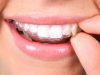guia33-palma-de-mallorca-clinica-dental-global-dent-balear-palma-de-mallorca-23705.jpg