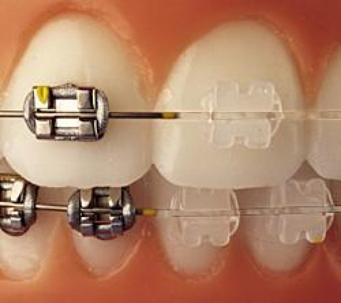 guia33-sant-feliu-de-llobregat-clinica-dental-clinident-6977.jpg